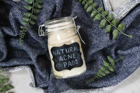 Homemade Anti-Acne Pads